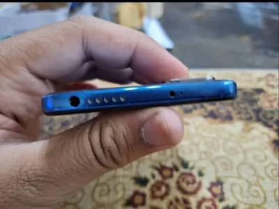 xiaomi note 11
