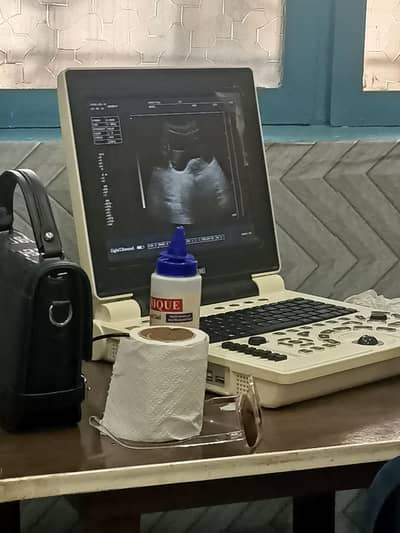 ultrasound machine