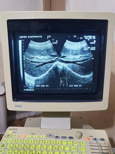 A 1 Aloka 1000 for sale