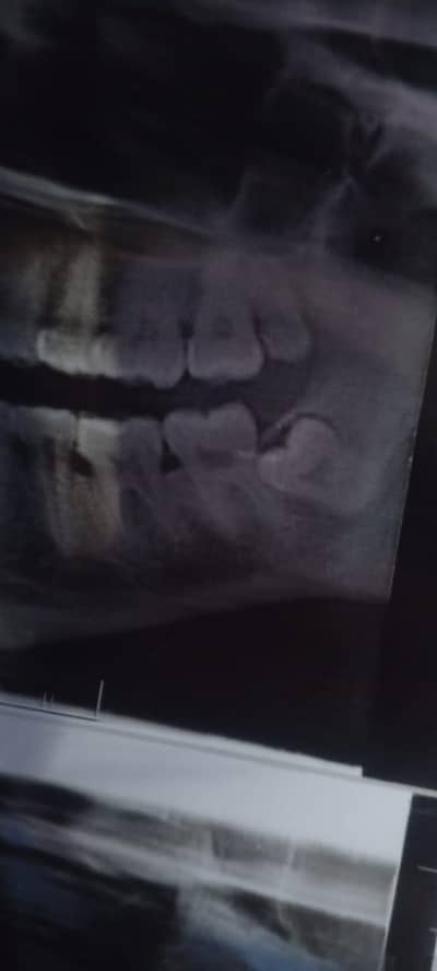 Dental assistant female satff required