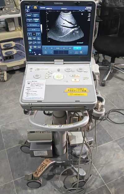 Toshiba Ultrasound Machine