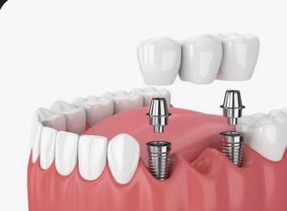 Need General Dentist (BDS) for private Setup