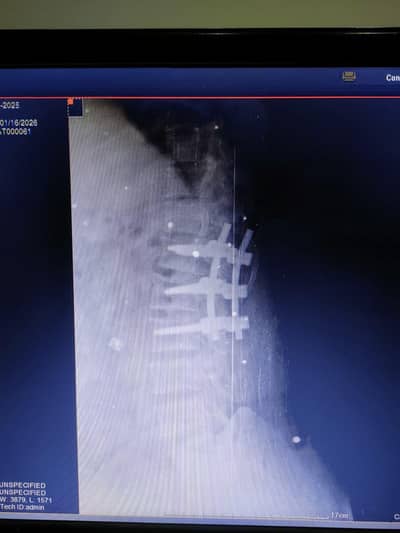 Suzuki Liana 2006 lxi | Suzuki Liana | Liana Car For Sale