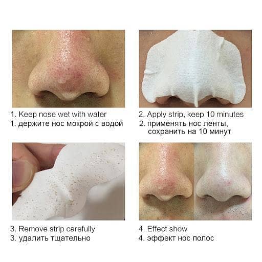 Pack of 6 Deep Cleansing Nose Strips for Blackheads – Random Brands