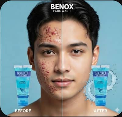 Benox face for oily skin.