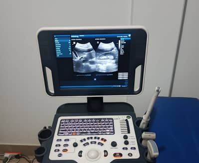 Mindray DC 30 color Doppler available for sale