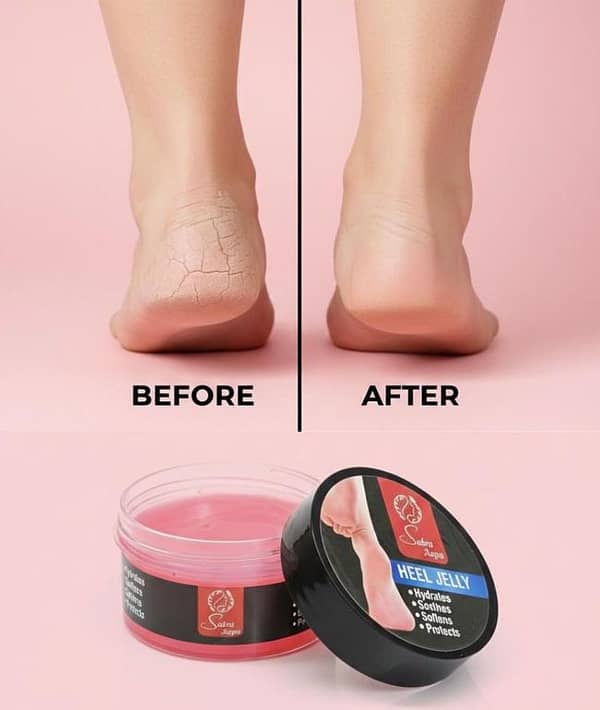Sabra Aapa Heel Jelly for Cracked Heels | Cracked Heels & Rough Skin – Urea & Moisturizing Formula