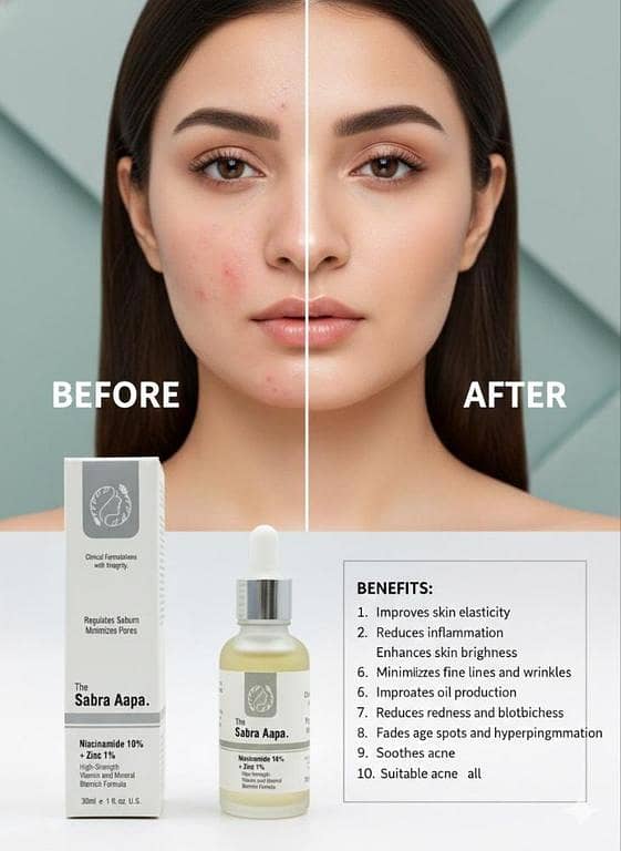 Sabra Aapa Niacinamide 10% + Zinc 1% Serum – 30ml | Oil Control, Pore Refining & Blemish Serum for Oily & Acne-Prone Skin