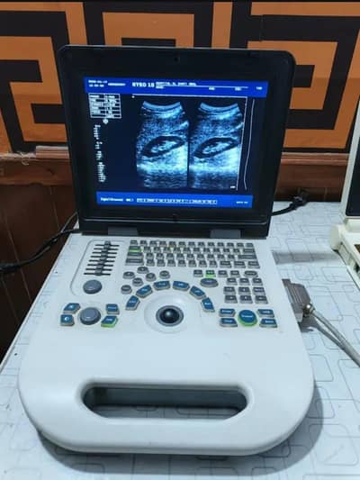 novadex ultrasound machine