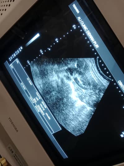 Original Toshiba Nemio 10 ultrasound machine