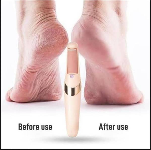 Rechargeable Electric Foot File Callus Remover Pedicure Machine Apparatus for Heels Grinding Device Foot Corns Remove Roller Feet Care  Original China - BIG SIZE