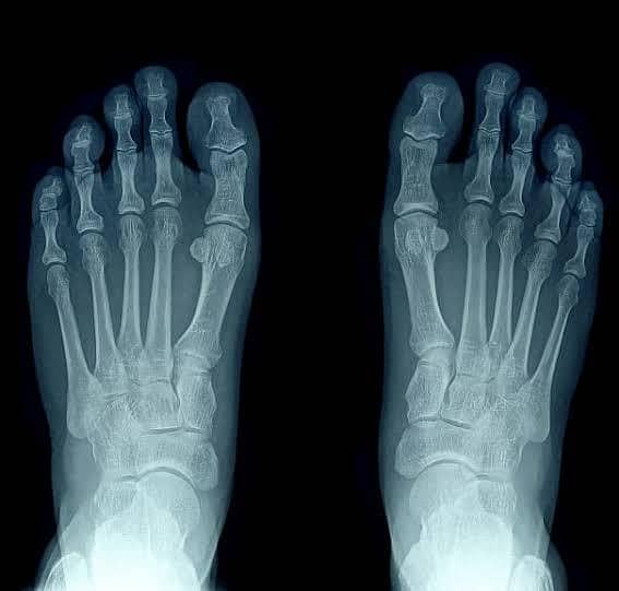 X Ray 0