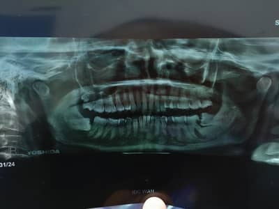 Required Dental surgeon