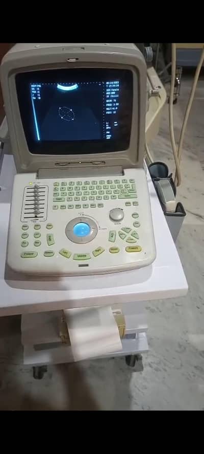 Portable Ultrasound Machine – Fully Working