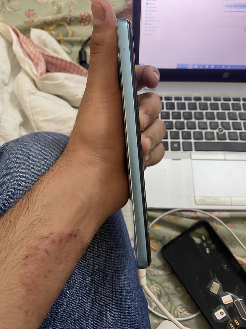 Redmi note 11 pro 1