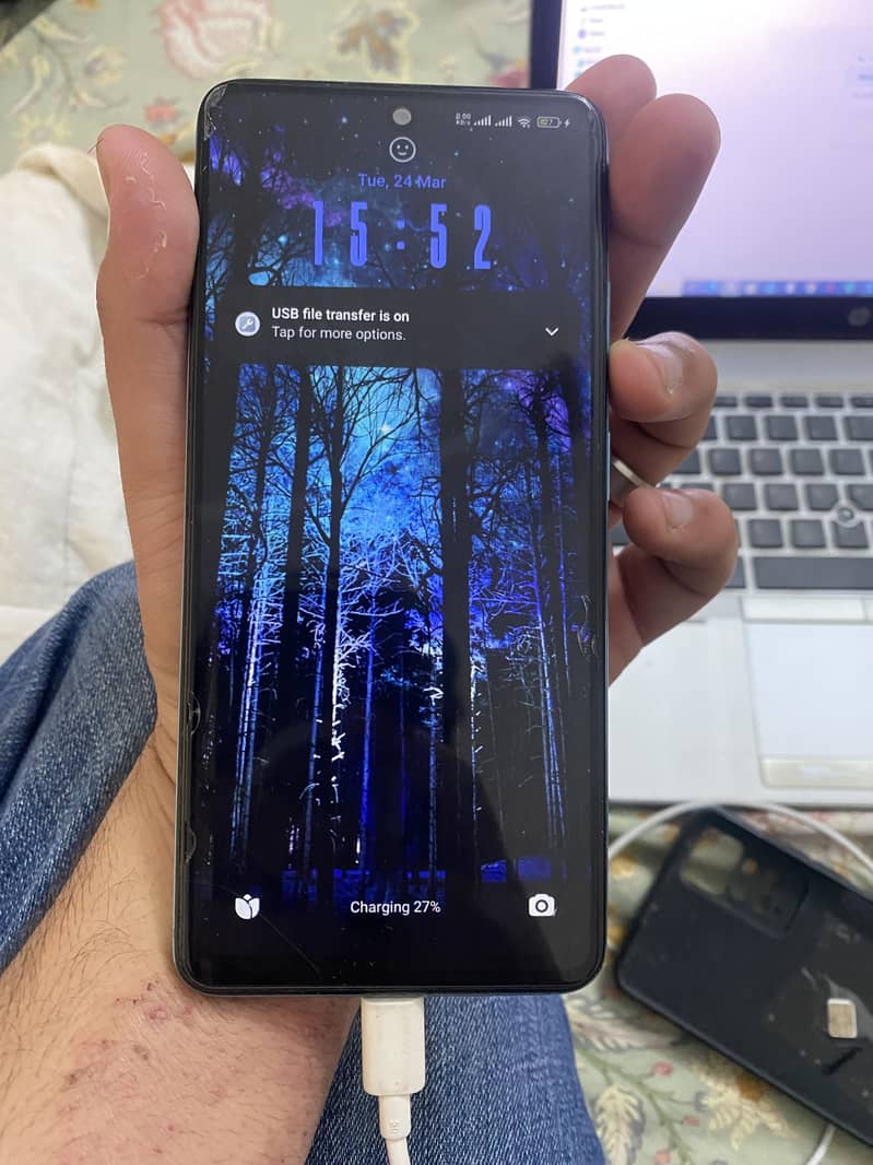Redmi note 11 pro 6