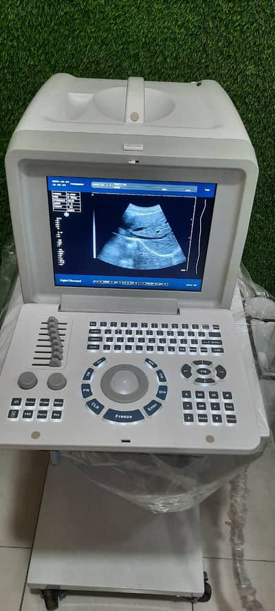 Used Ultrasound Machine