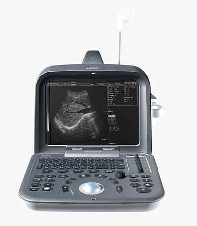 Brand new Color ultrasound Ultrasound Machines - Portable Ultrasound