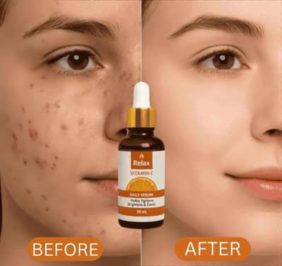 Whitening Vitamin C Serum – 30ml (All Skin Types)