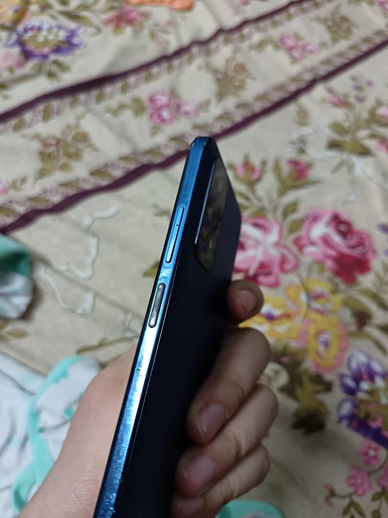 redmi note 11 3