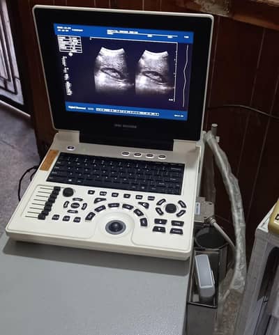 ultrasound machine