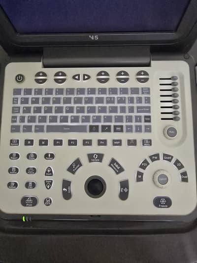 ultrasound machine  n5 with 2 prob