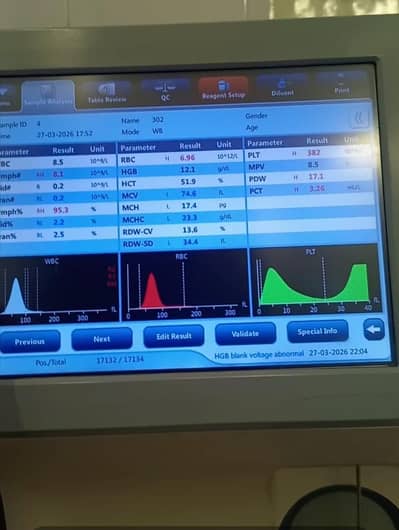 For Sale Haematology analyzer Mindray BC 20s