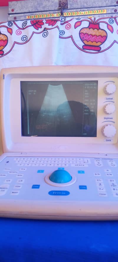 Linkton UG-B80 B-Mode Ultrasound Machine for Sale (Good Condition)
