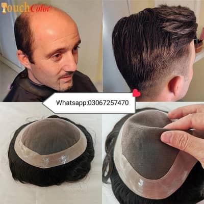 men wig imported quality_hair patch_hair unit_(0'3'0'6'7'2'5'7'4'7'0)
