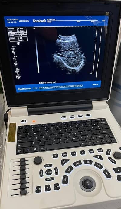 New Ultrasound Machine