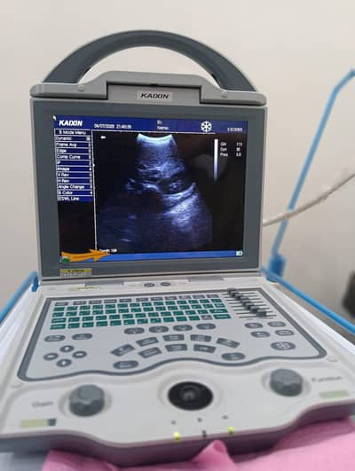 Kaixin Portable Ultrasound Machine - Excellent Condition - 2026 Model