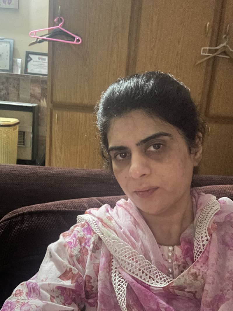 Hydrafacial machine 7