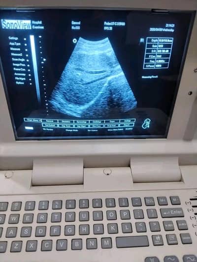 Sono viiwo machine for sale 0323//400//28//93