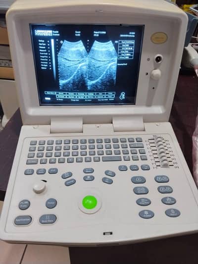 ultra sound machine  0323**400**28**93 my WhatsApp