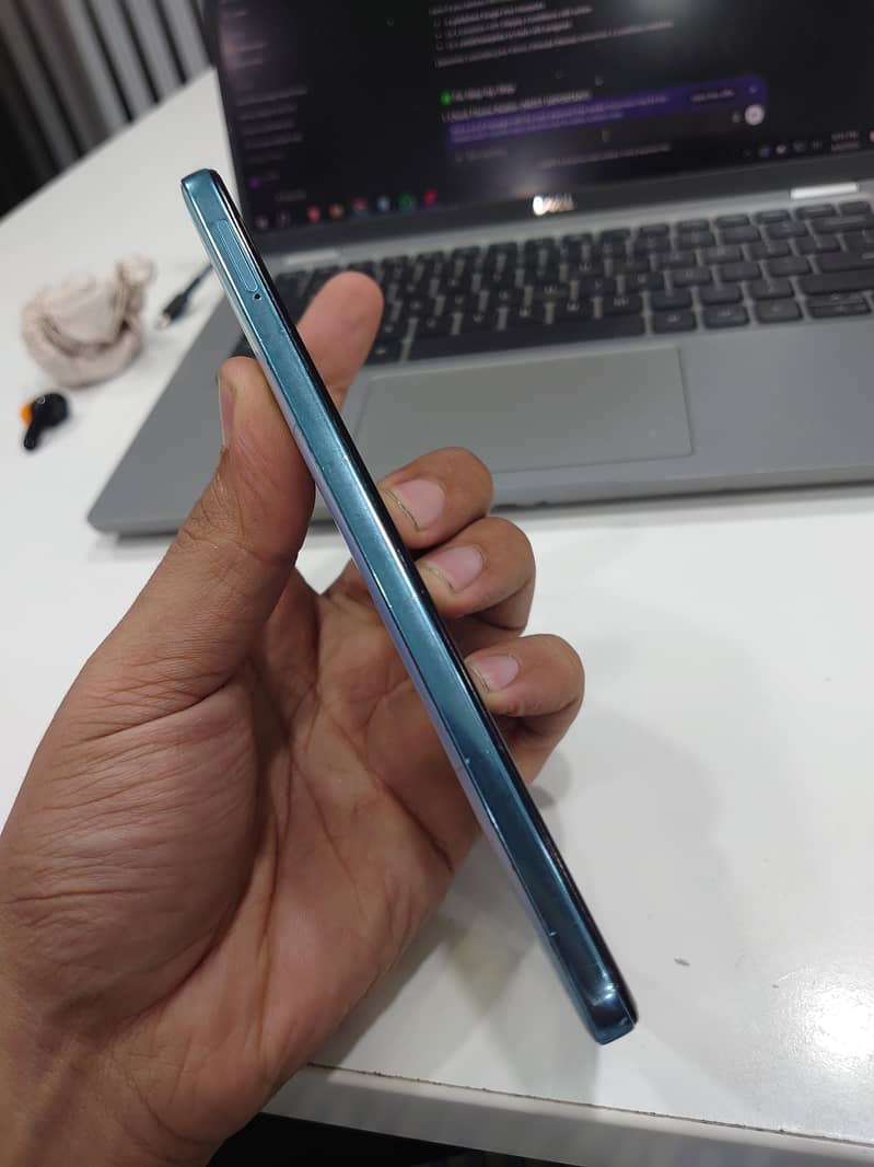 Redmi note 11 5