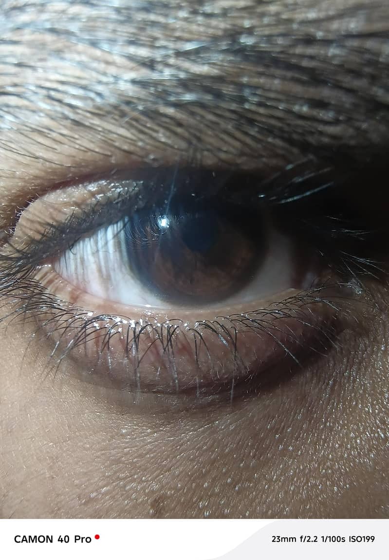 Tecno camon 40 pro 1