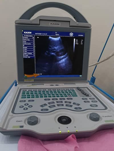 Kaixin Portable Ultrasound Machine for Sale - Excellent Condition
