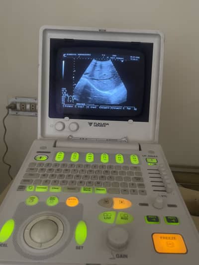 Ultrasound Machine