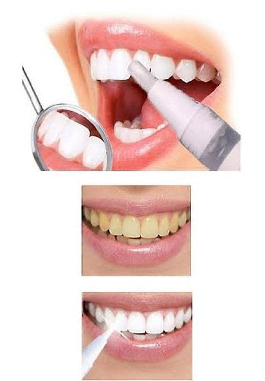 Teeth Whitening Pen | Natural Teeth Whitening Gel Pen that  Removes Plaque and Stains Clean Teeth Serum | Best Tool For Teeth Whitening