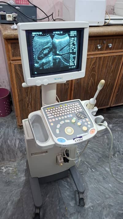 Ultrasound machine New/Used China/Japan Available Whtsap-03126807471