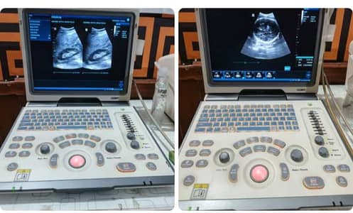 Ultrasound machine New/Used Stock Available 03126807471