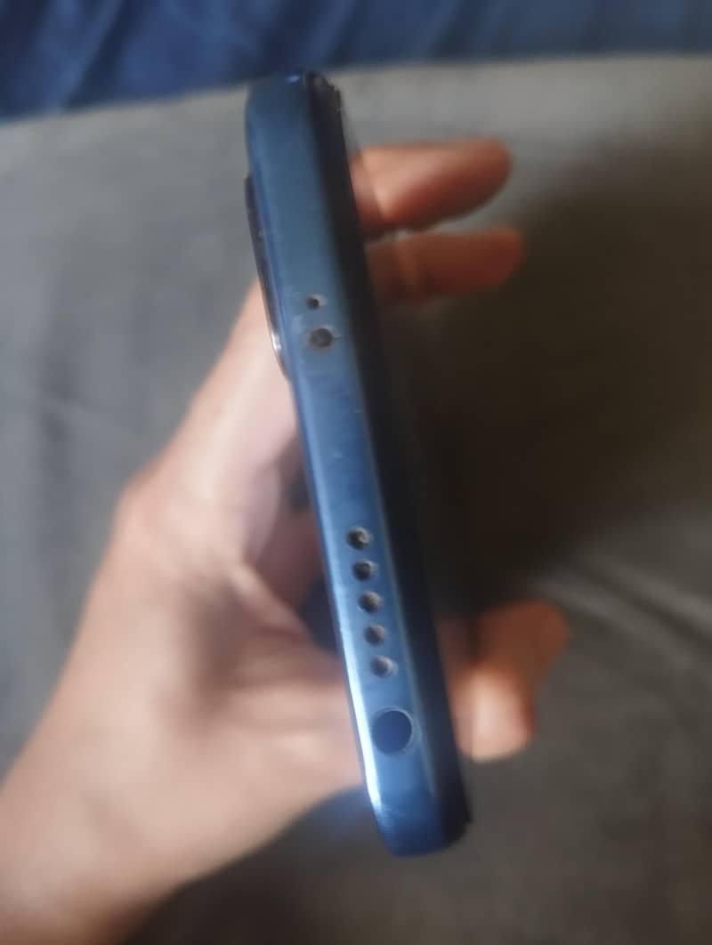 redmi note 11 3