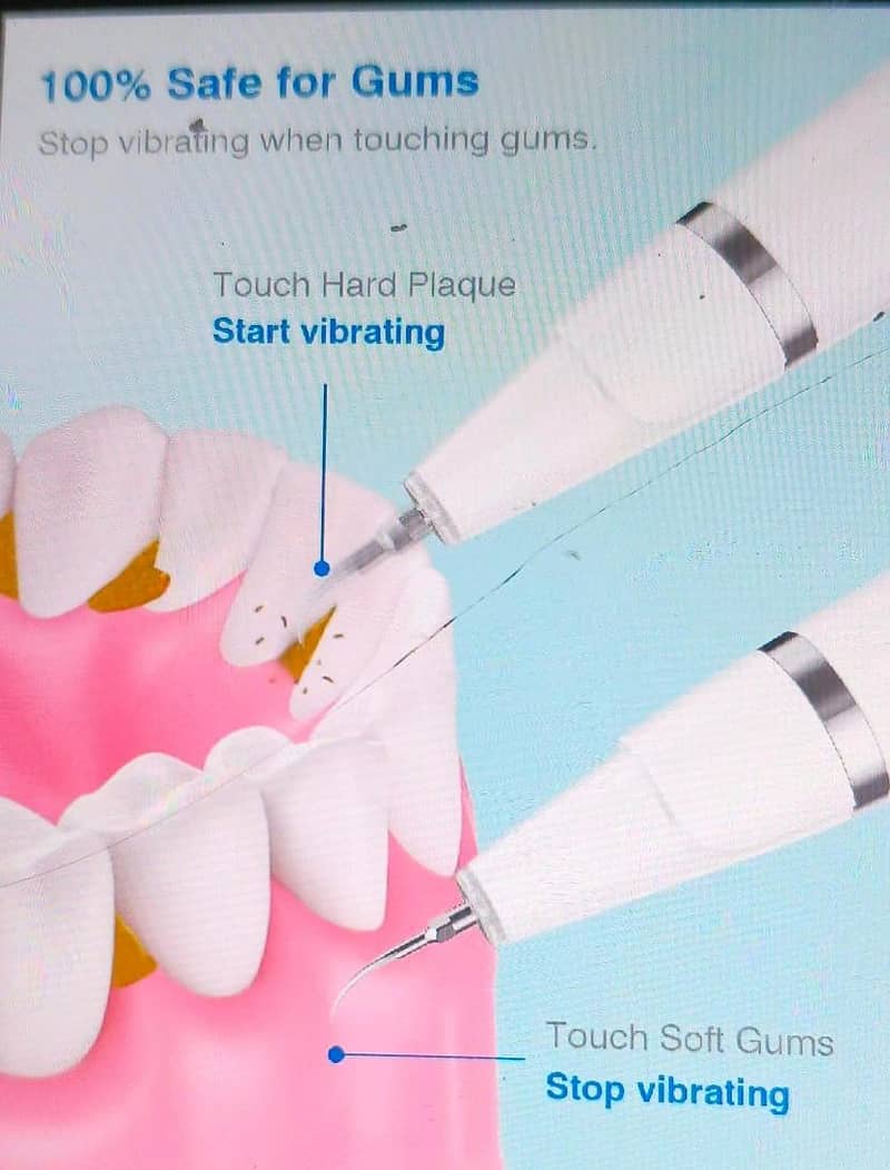 Tooth Cleaning Set for Caring 3