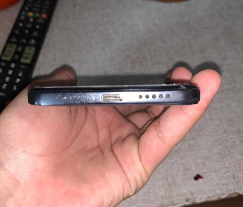 Redmi note Note 11 3