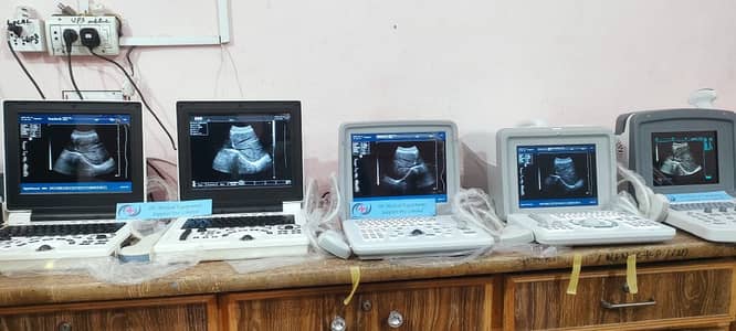 New / Used Chinese machine & Refurb Japanese Grayscale / color Doppler