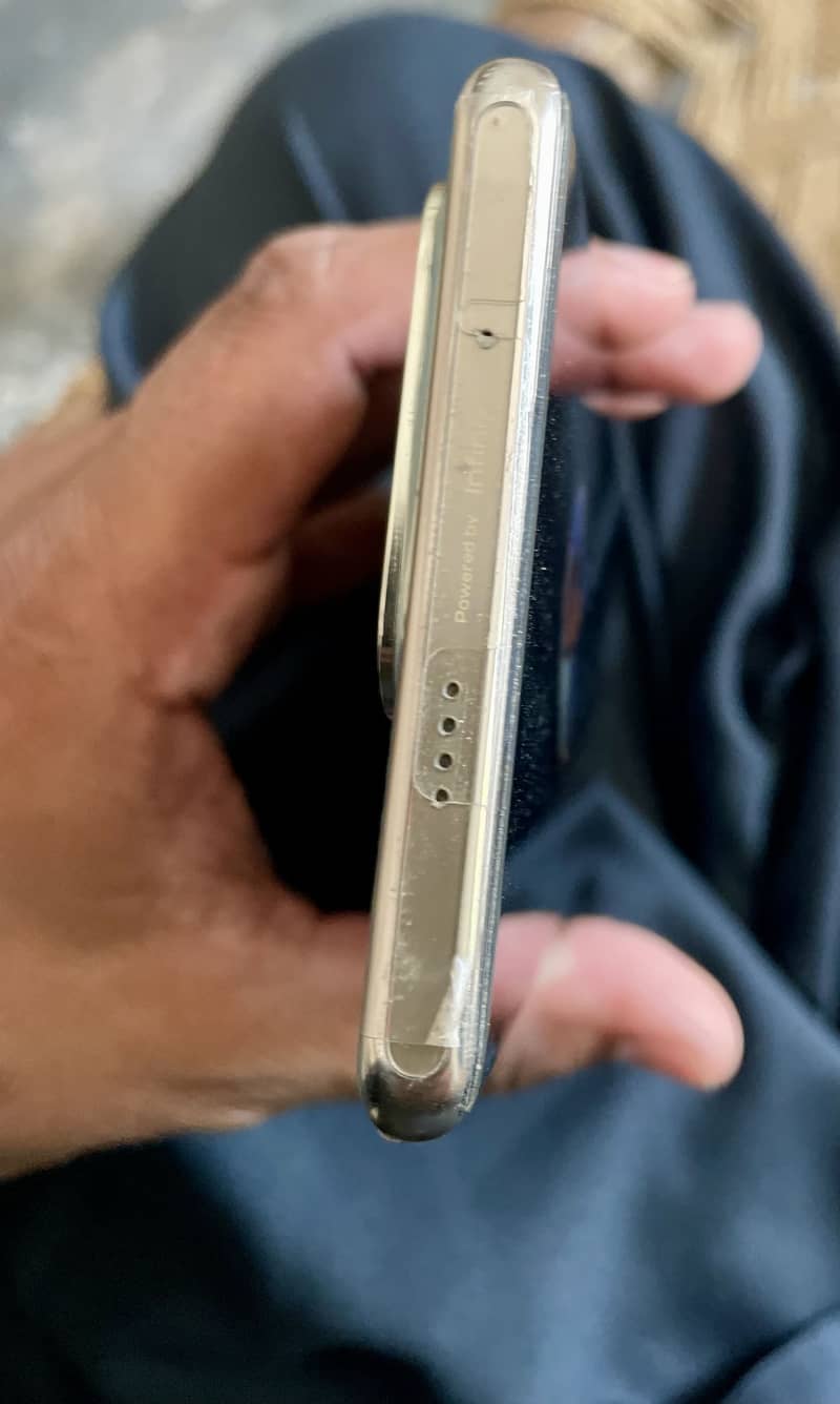 Infinix zero 30 1