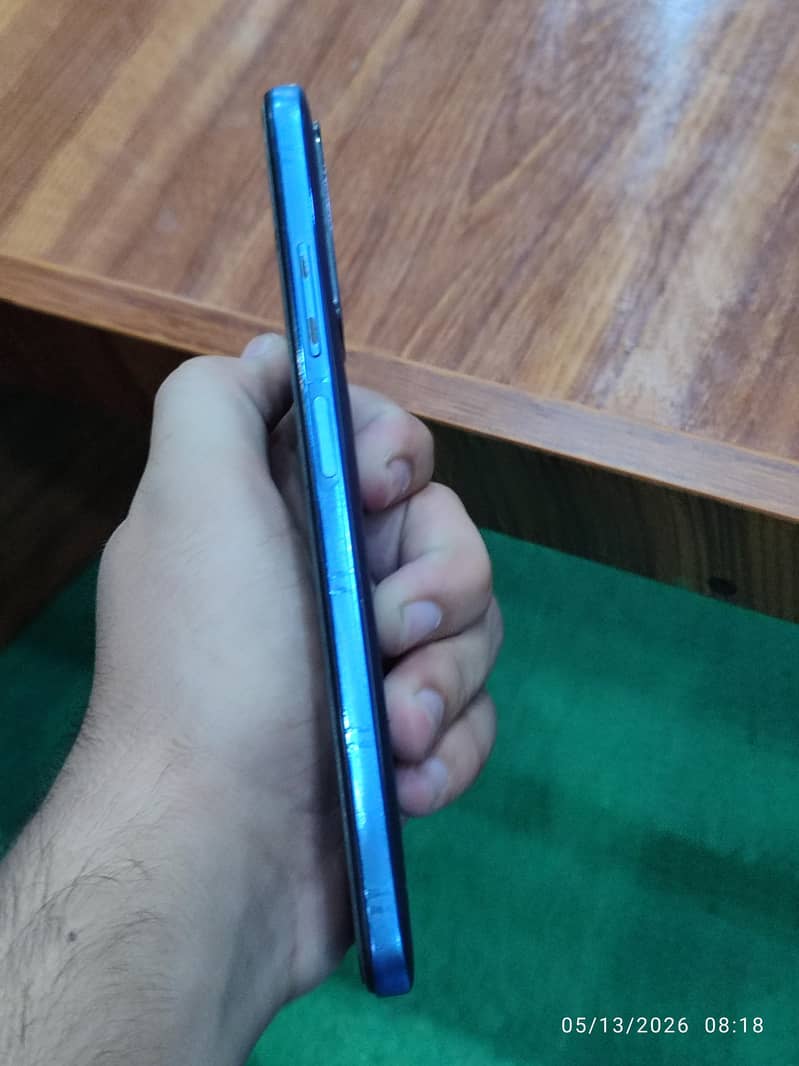 Redmi Note 11 3
