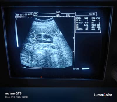 ultrasound portable