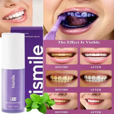 hi smile teeth white and cleen