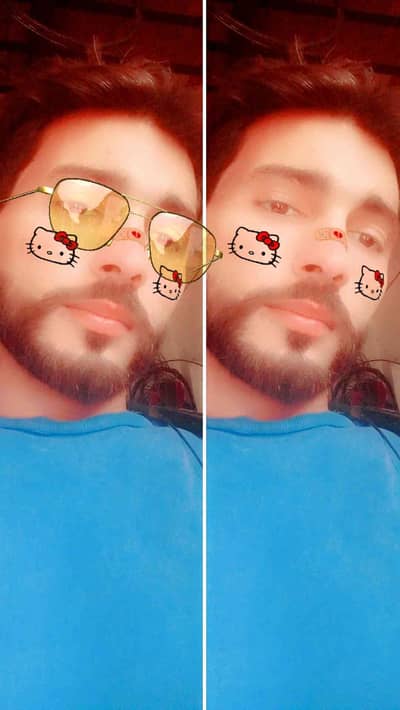 Rana shan 